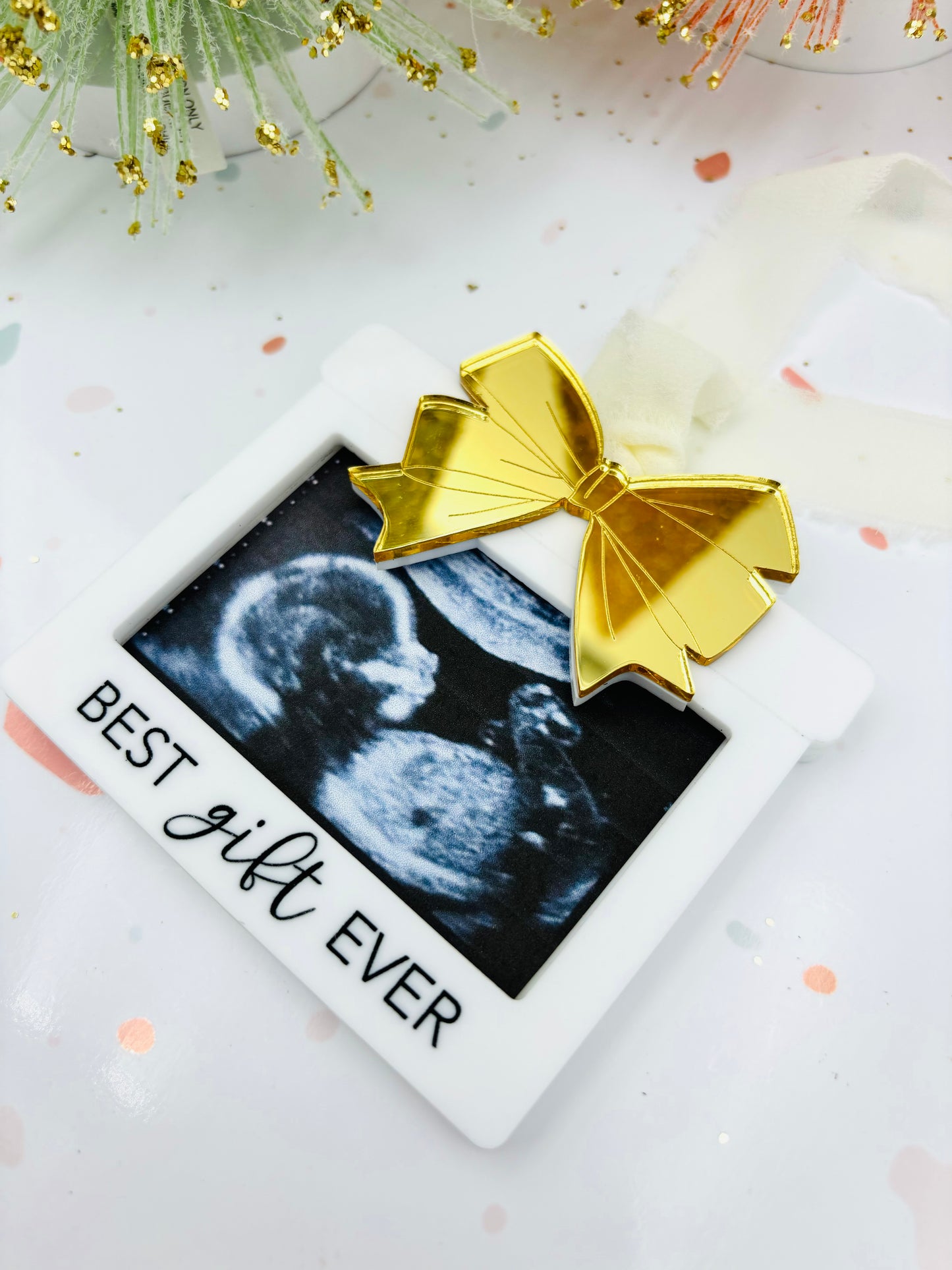 Ultrasound photo frame Christmas ornament