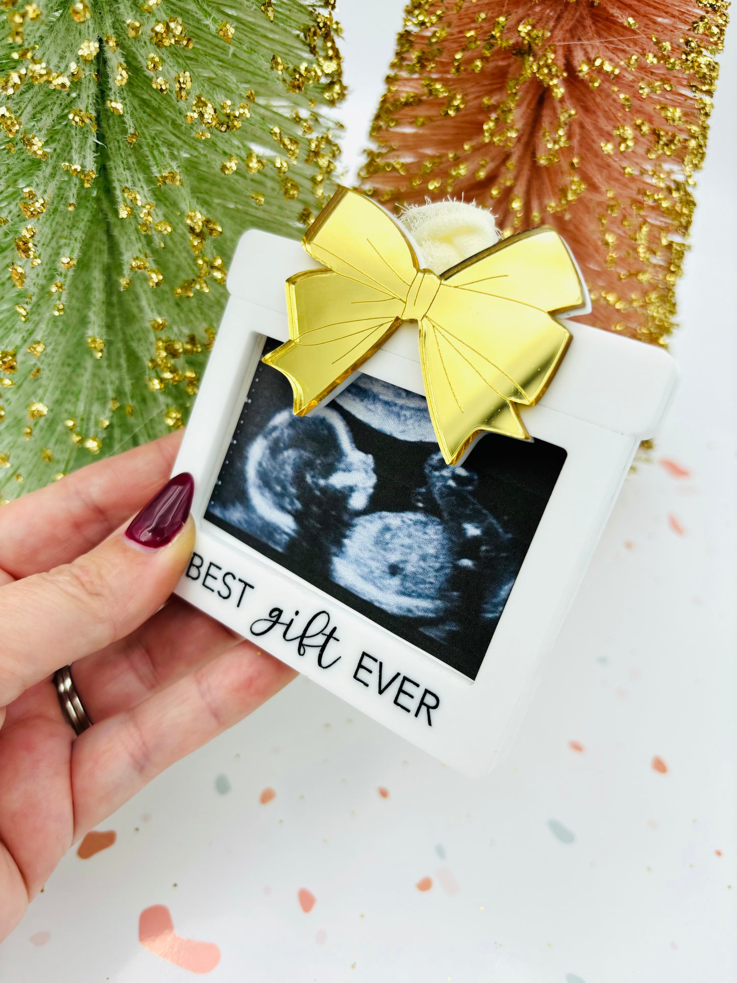 Ultrasound photo frame Christmas ornament